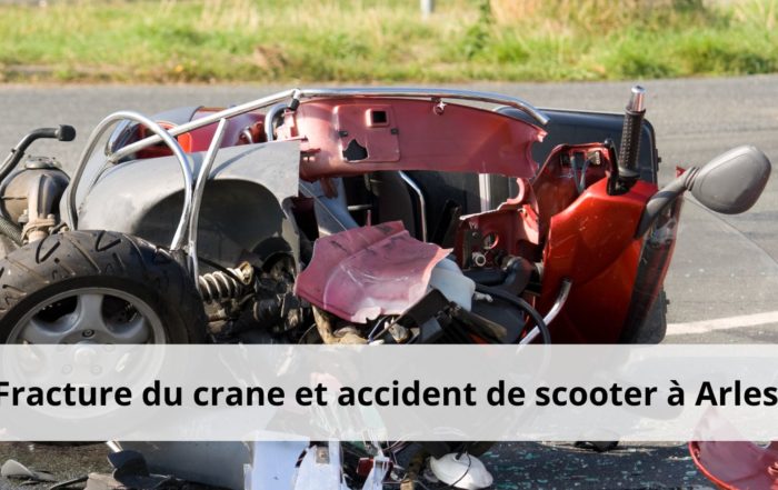 Fracture du crane et accident de scooter