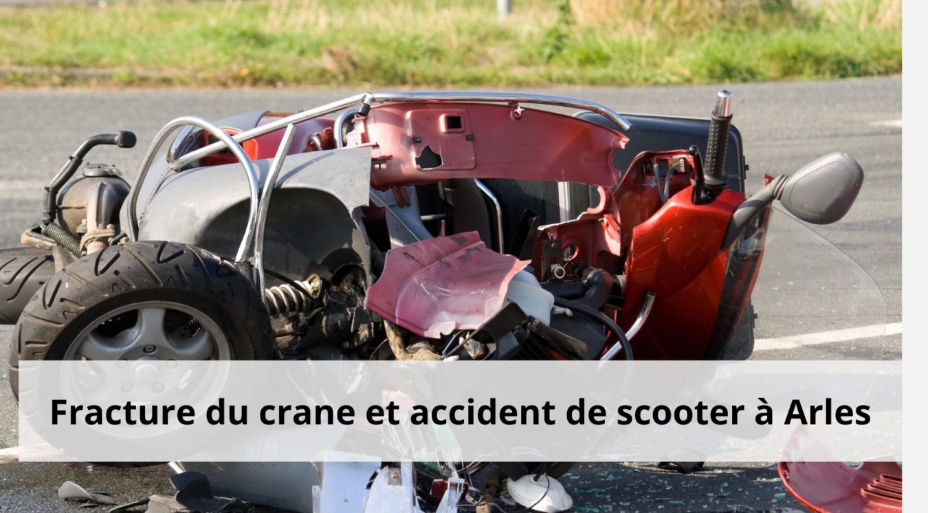 Fracture du crane et accident de scooter